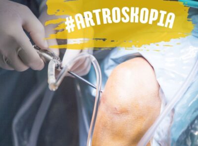Artroskopia w praktyce.